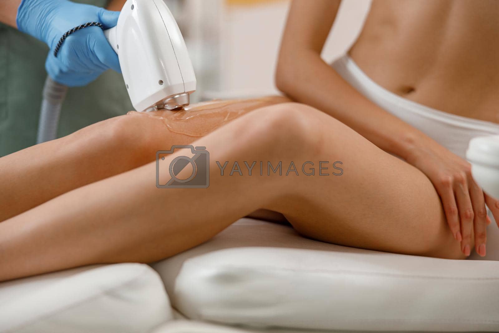 Closeup of legs skin epilation with ipl machine in beauty salon. Hair removal, cosmetology
