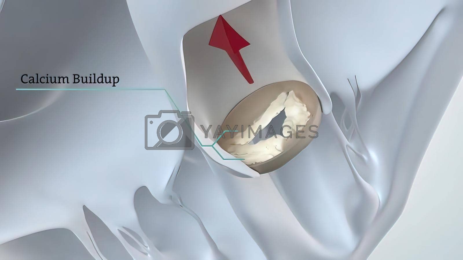 Royalty free image of The Heart anatomy. 3D Medical of Aortic Valve by creativepic