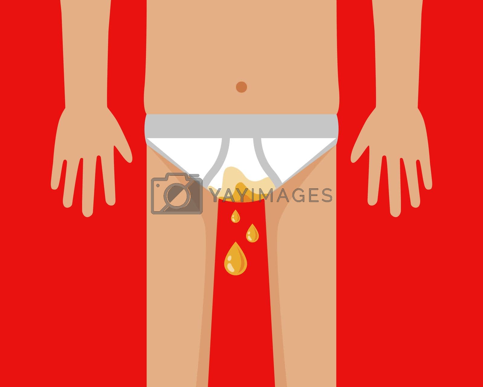 Royalty free image of man in shorts pissing. urinary incontinence disease. by PlutusART