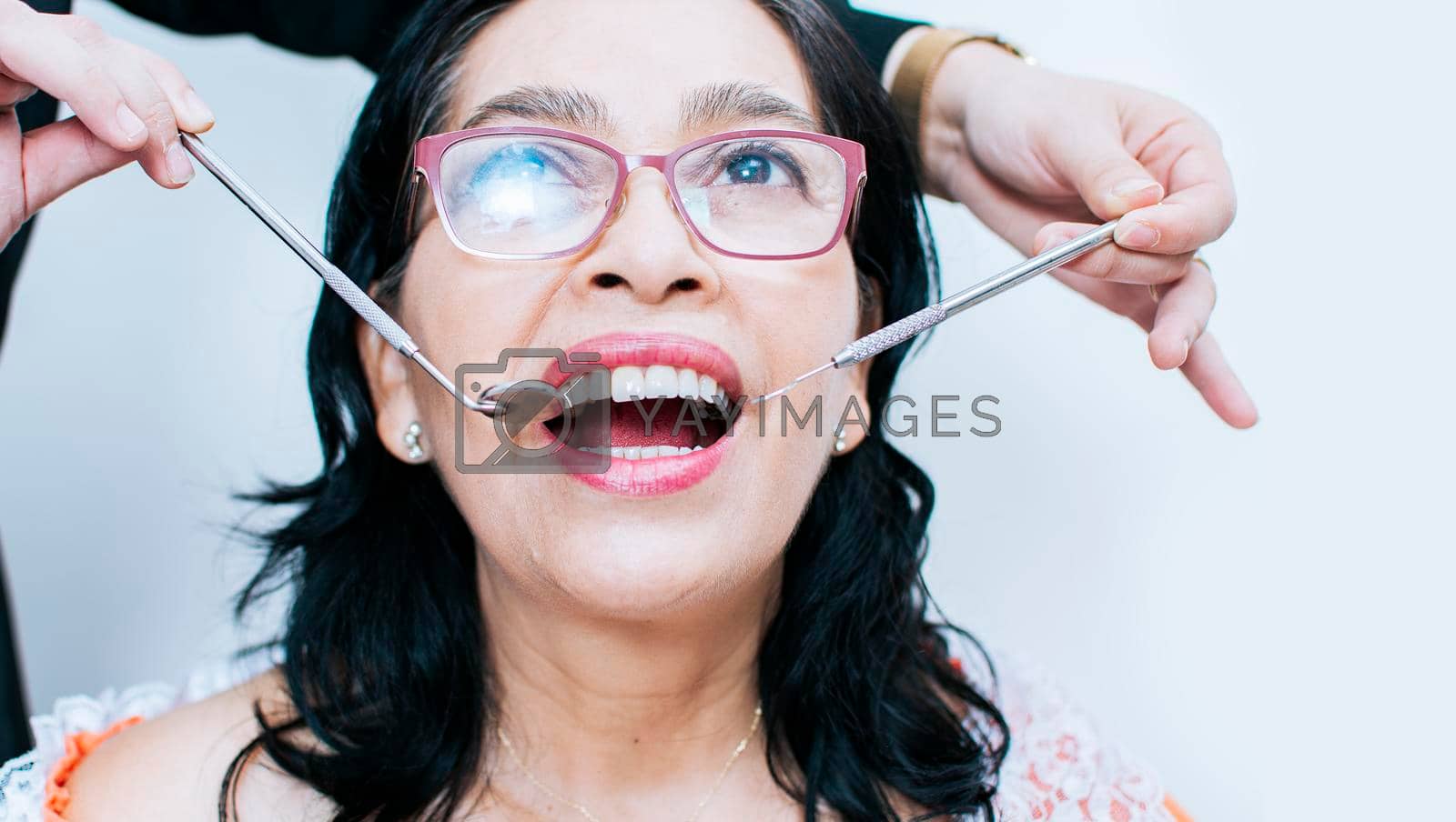 Close up of dentist with patient, dentist performing root canal treatment on patient, dentist performing dental checkup, Patient checked by dentist