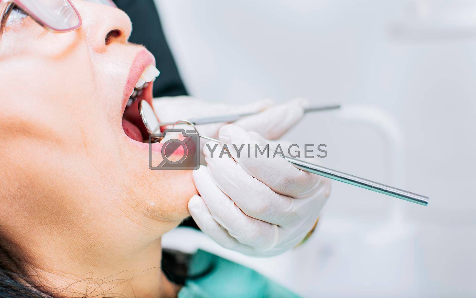 Dentist checking patient's mouth, Close up of patient checked by dentist, close up of dentist's hands checking patient's mouth, Dentist performing stomatology