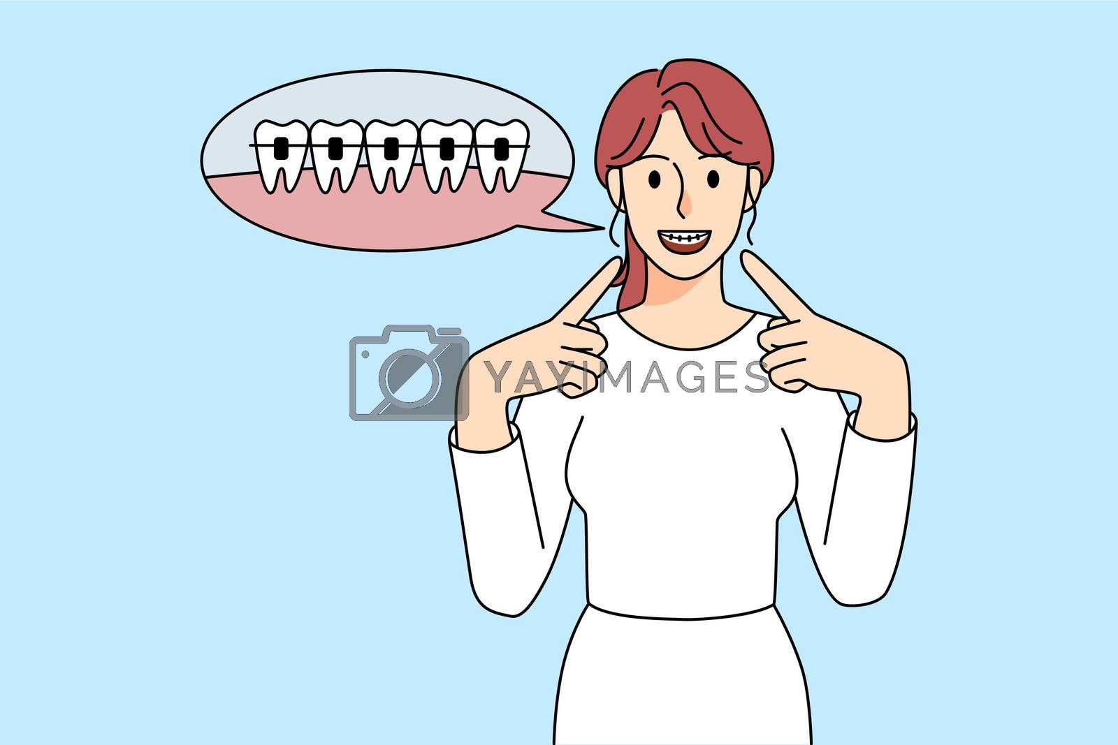 Happy young woman point at dental braces on teeth. Smiling girl enjoy brace treatment for healthy even tooth. Dentistry and oral care concept. Vector illustration.