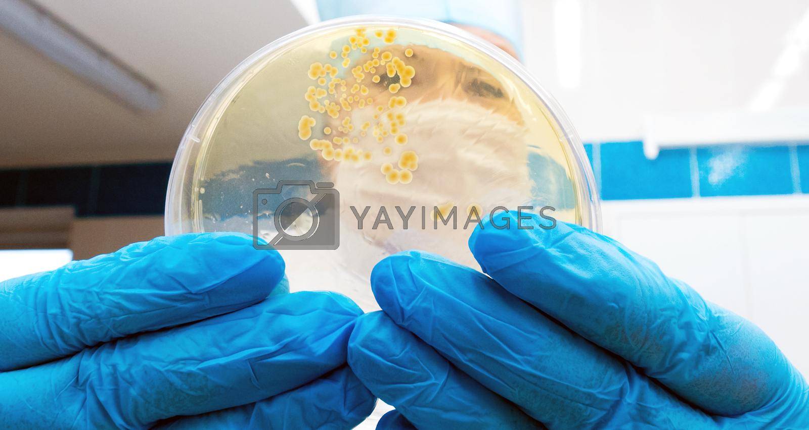 Royalty free image of Hand Holds Petri Dish with Bacteria Culture by Hil