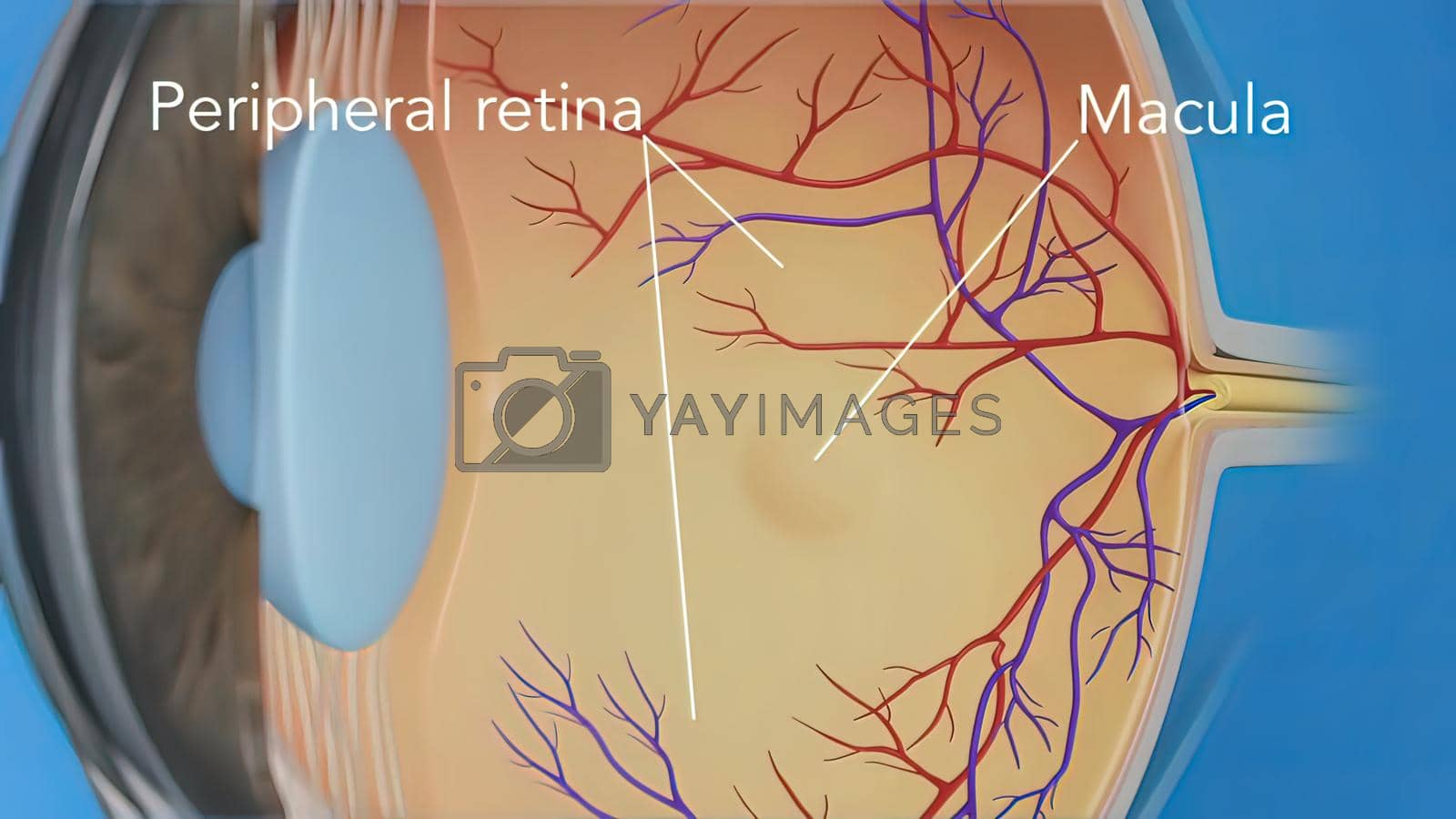 Royalty free image of illustration Eye's Anatomy, Wet Macular Degeneration by creativepic