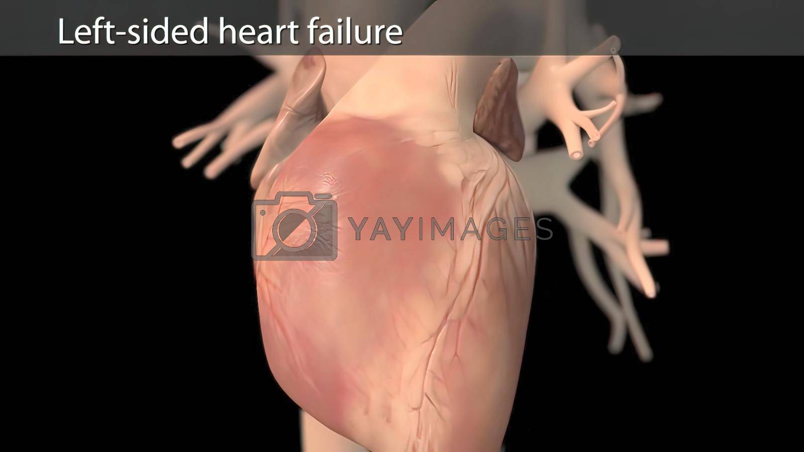 Royalty free image of 3D Animated right-sided heart failure - beating heart by creativepic