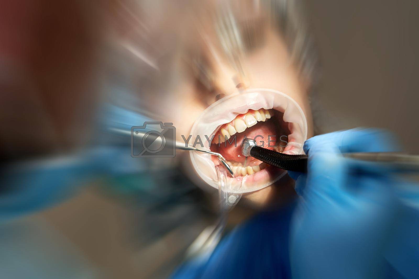 Lady patient sitting in stomatology chair, dentist drilling tooth, modern clinic