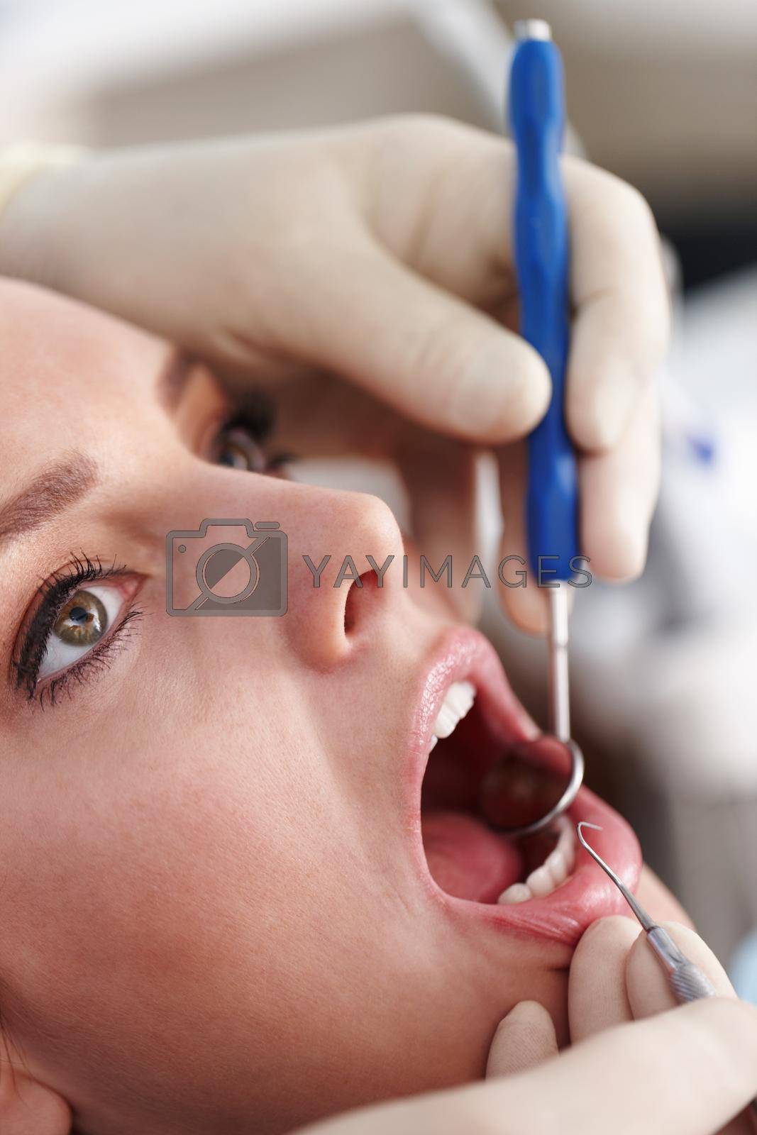 Dental cleaning. Closeup of female patient at clinic for dental treatment