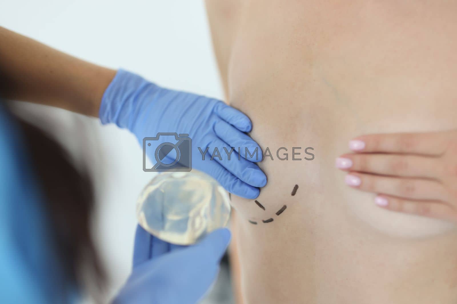 Royalty free image of Surgeon holds silicone implant for breast augmentation by kuprevich