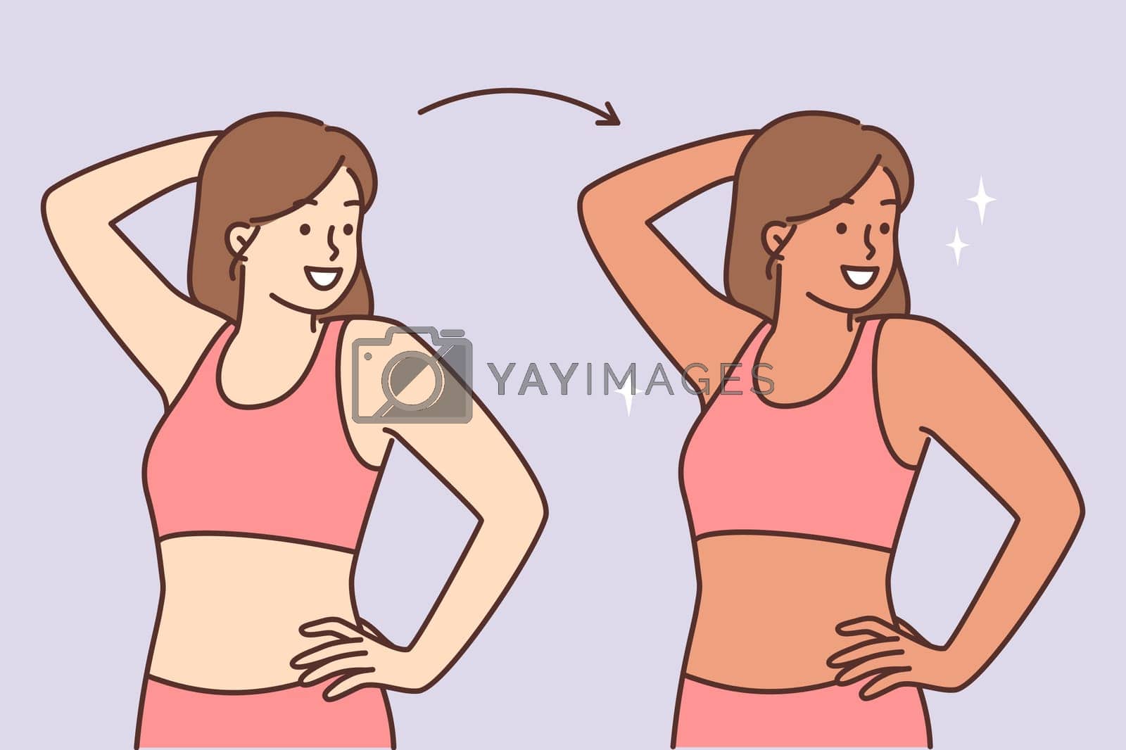 Royalty free image of Woman before and after sunbathing or going to spa with visit to solarium to get tanned skin color by Vasilyeu