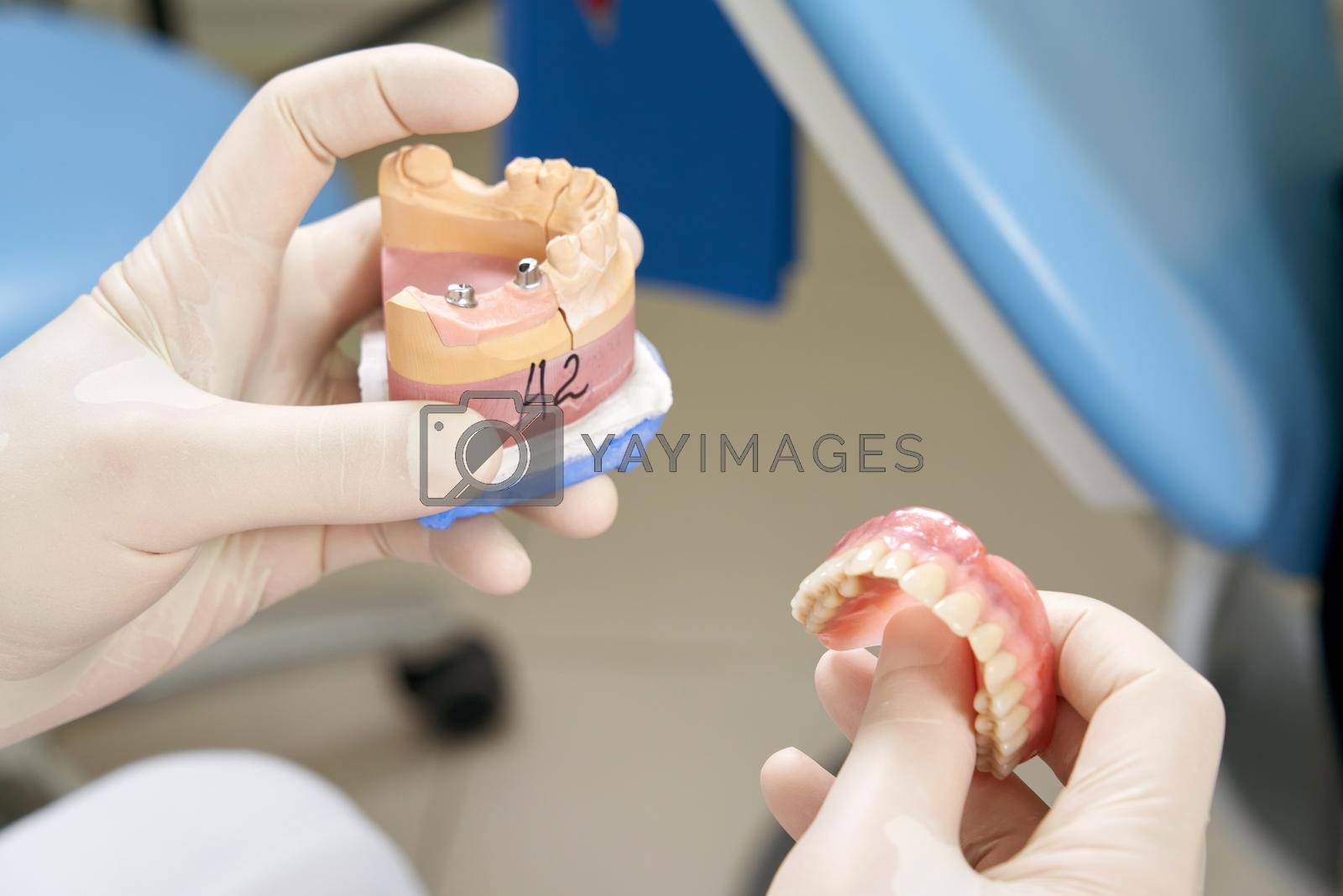 Male dentist showing his female patient a dental implant in modern clinic