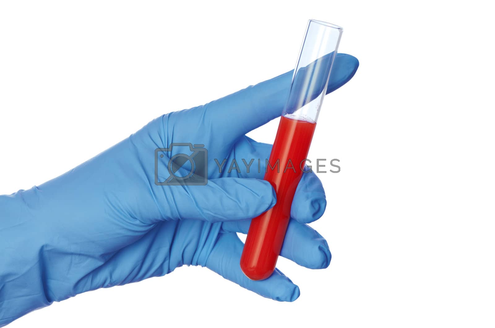 Royalty free image of sample of bloods by merzavka