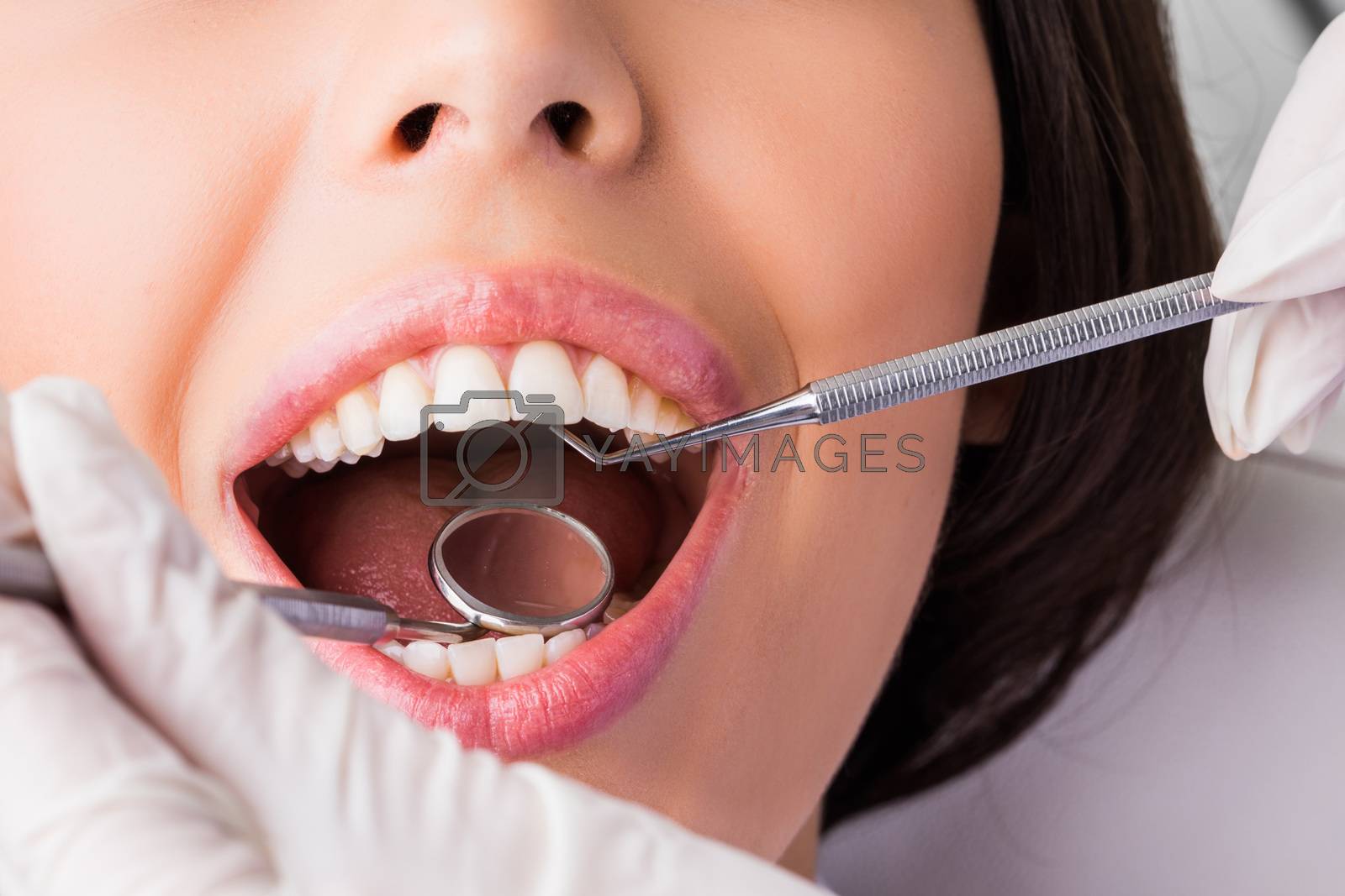 Close-up of open mouth during oral dental checkup at the dentist
