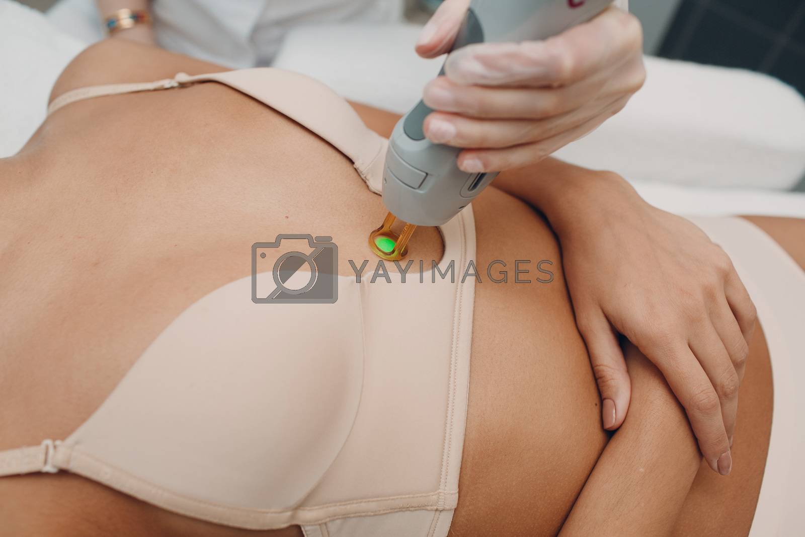 Royalty free image of Breast Laser epilation and cosmetology. Hair removal cosmetology procedure. Laser epilation and cosmetology. Cosmetology and SPA concept. by primipil