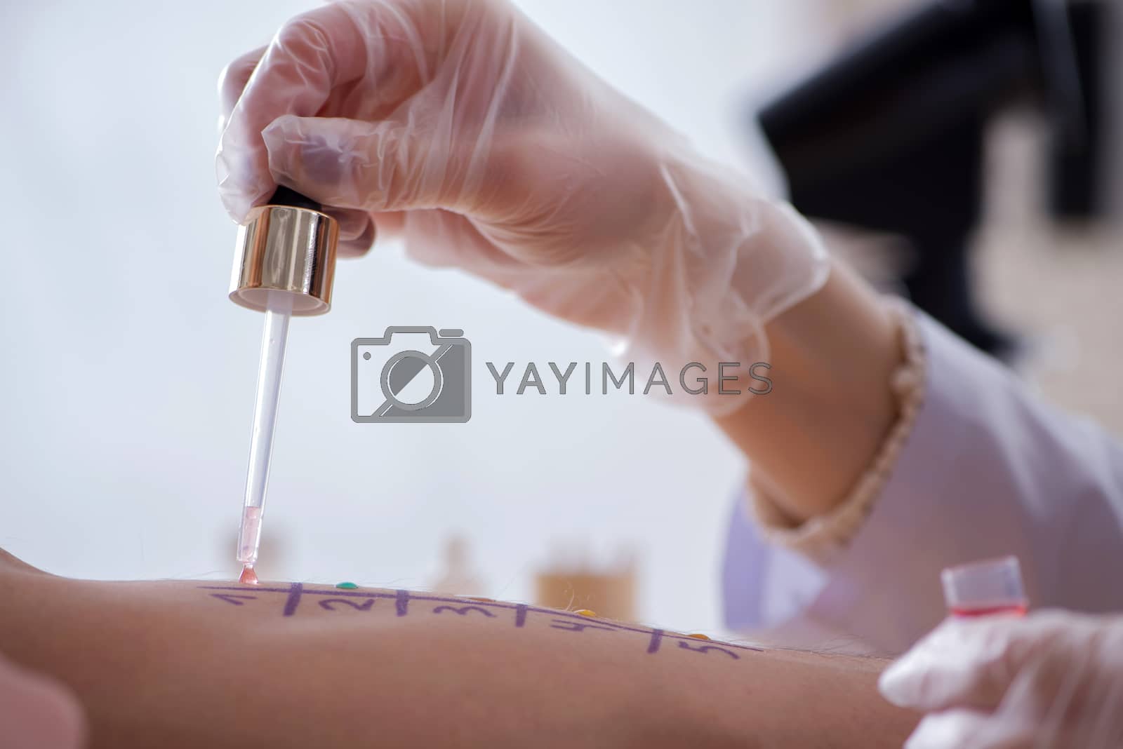 Royalty free image of Doctor testing allergy reaction of patient in hospital by Elnur