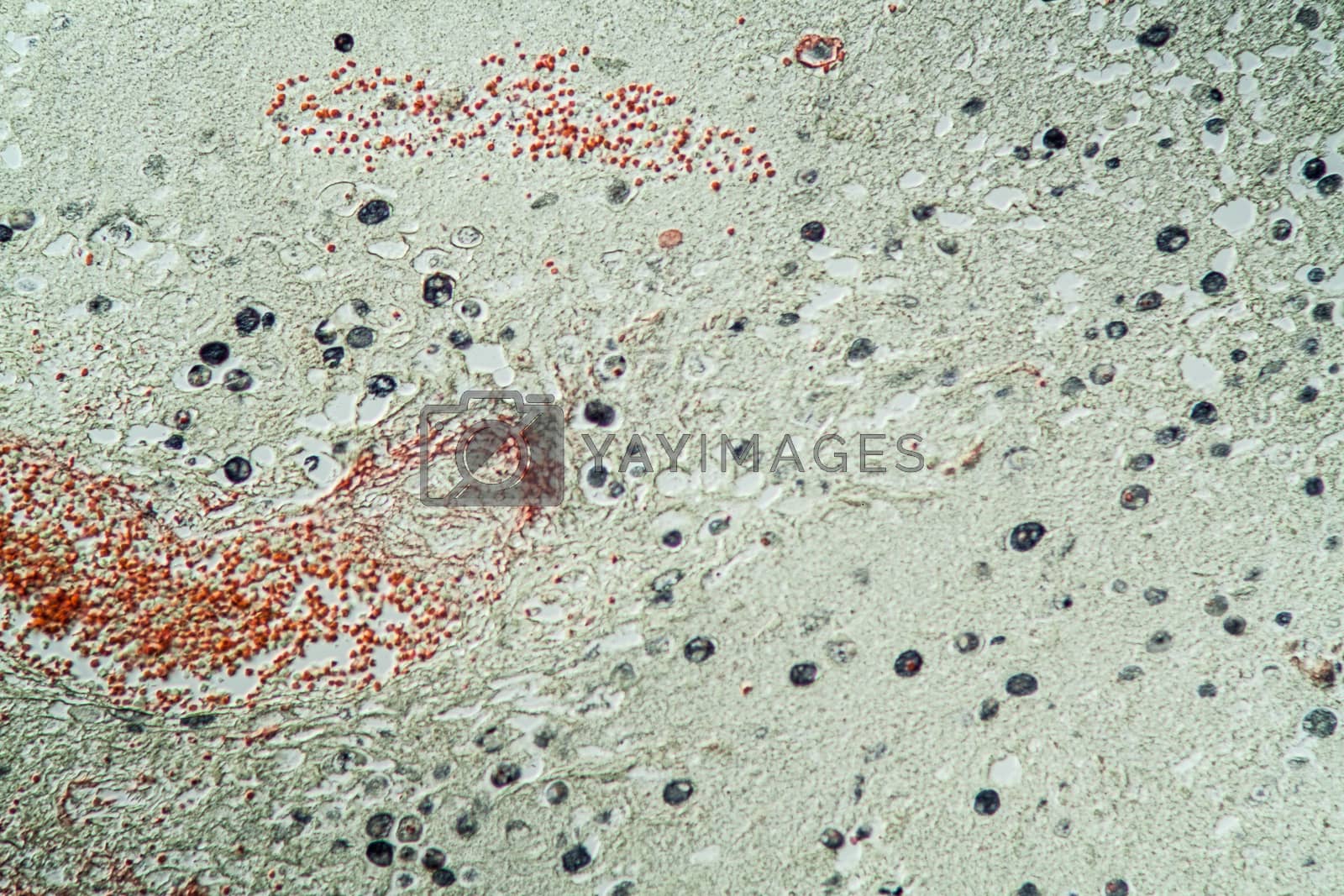 Royalty free image of Amoeba parasite tissue under the microscope 200x by Dr-Lange