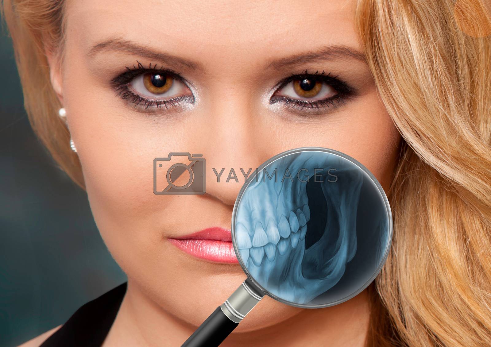 Royalty free image of X-ray with a magnifying glass from the visual field of a person' by 25ehaag6