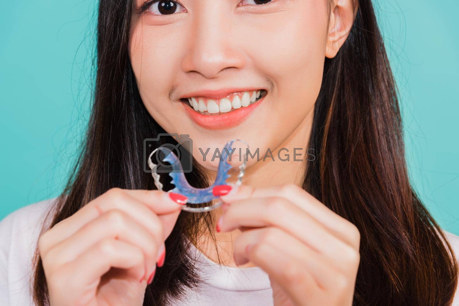 Royalty free image of Teeth retaining tools after removable braces by Sorapop
