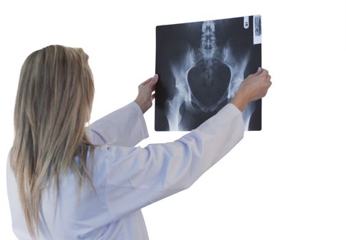 Doctor looking at an xray