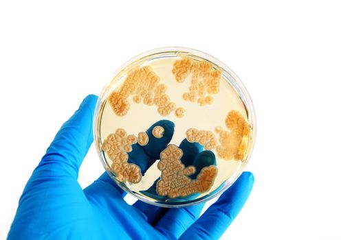 fungi microorganisms on agar plate