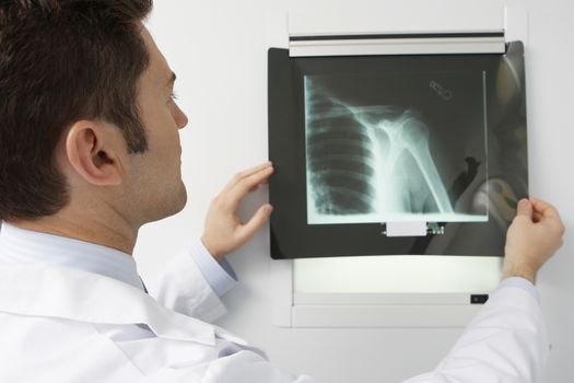 Doctor examining x-ray in hospital