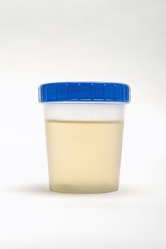 Urine Sample In Plastic Container