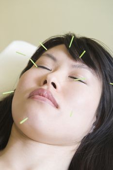 Asian woman with acupuncture needles in her face eyes closed