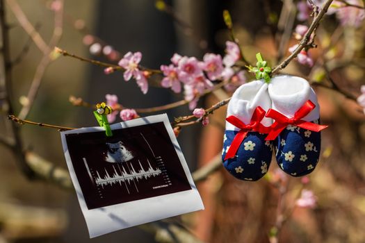 Baby slippers and ultrasound image hanging on a branch of blossoming tree