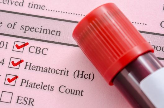 CBC, Hemotocrit, Platelets Count with request screening test