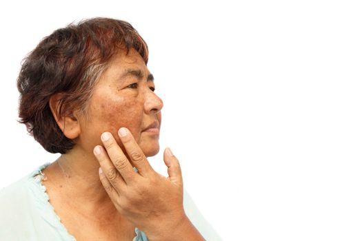 old rural woman with blemish , acne , mole and wrinkle on her face ( isolated background and blank area at right side ) ( anti-aging concept )