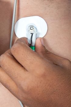 Nurse placing an electrode on patient's chest