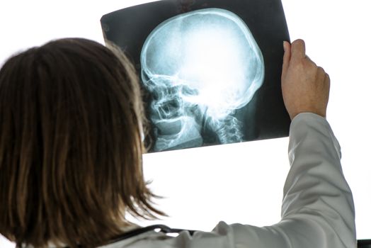 Doctor analyzing human skull x-ray screening image