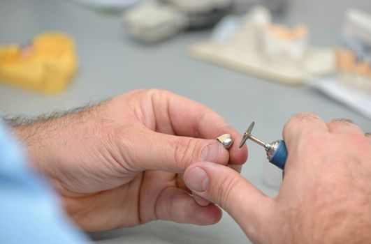 Dental technician working in  laboratory
