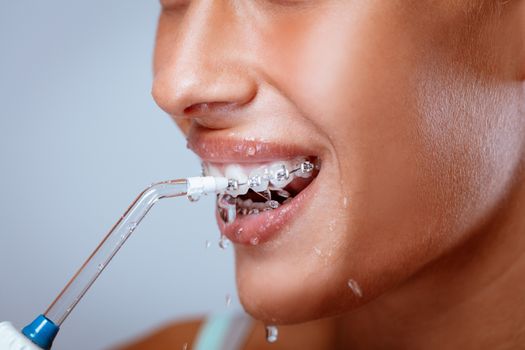 Close-up of a smiling woman face with braces cleaning her teeth with oral irrigator. 