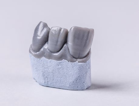Artificial tooth