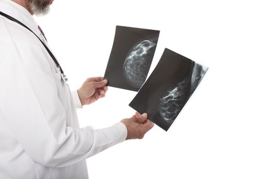 Doctor looking at a mammography