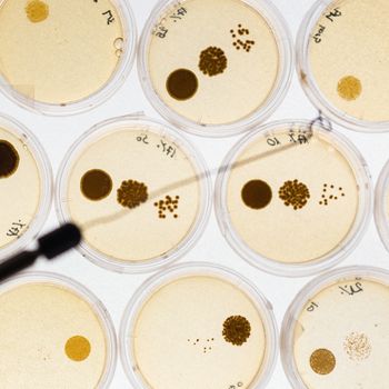 Growing Bacteria in Petri Dishes.