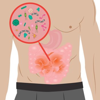 Stop  infection overgrowth in  intestine vector illustration