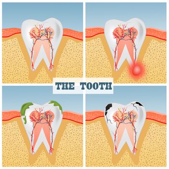 illustration of tooth anatomy scheme