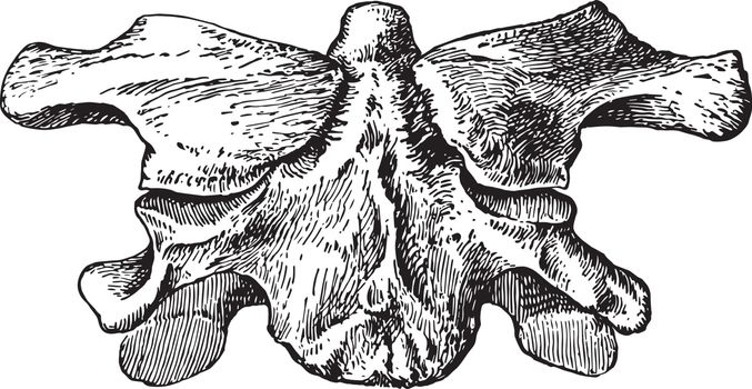 Atlas Without Anterior Arch, vintage illustration.
