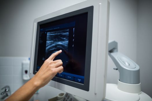 Nurse pointing at ultrasonic monitor