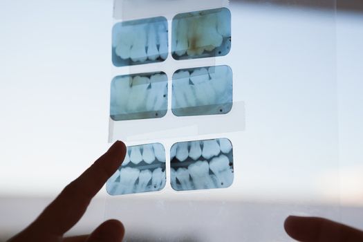 Dentists looking and pointing to xray