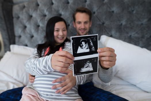 Man and pregnant woman looking at sonography