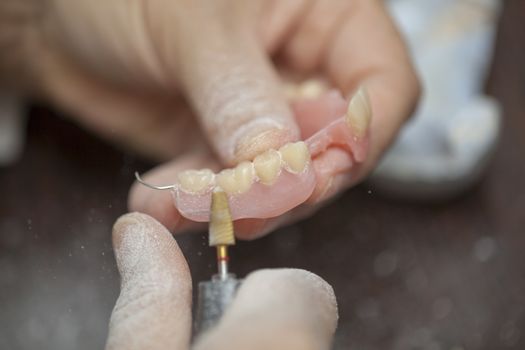 Dental technician make denture prothesis in dental laboratory