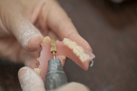 Dental technician make prothesis denture in dental laboratory