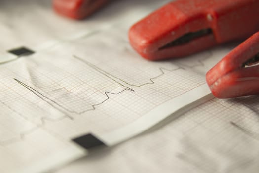 Close up of an electrocardiogram in paper form.
