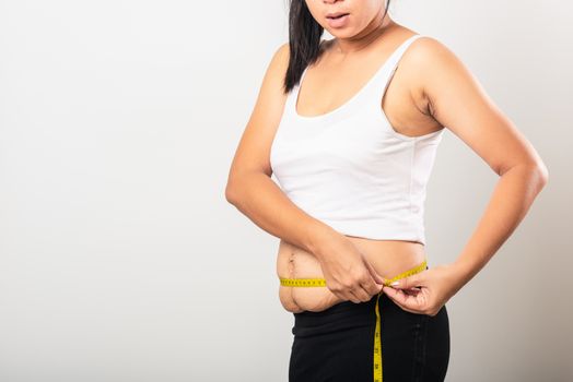 woman use section postpartum scar measuring waist stretch mark l