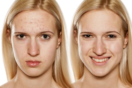 Comparative portrait of female face, before and after  makeup