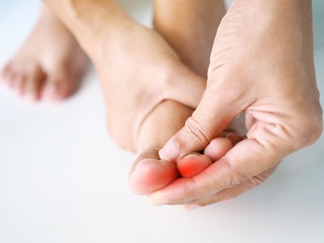 Close-up young asian woman with painful and inflamed on toe