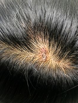 Close-up of black hair of Asians with hair and mold health