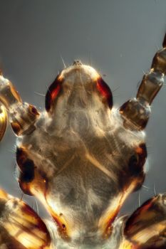 Head of the head louse with sucking mouth tools